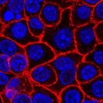 cbsn fusion what makes promising pancreatic cancer drug different from chemotherapy thumbnail