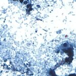 ap26189642009611