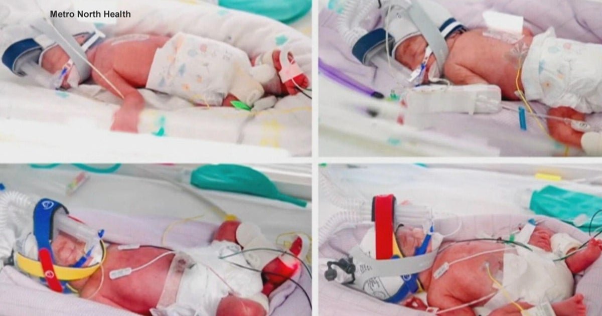 cbsn fusion australian woman gives birth to rare identical quadruplets thumbnail