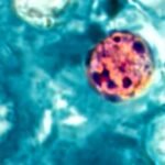 cbsn fusion taylor farms recalls iceberg lettuce after link to diarrhea causing parasite thumbnail