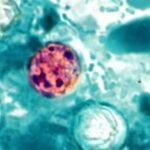 cyclospora cyclosporiasis 1280