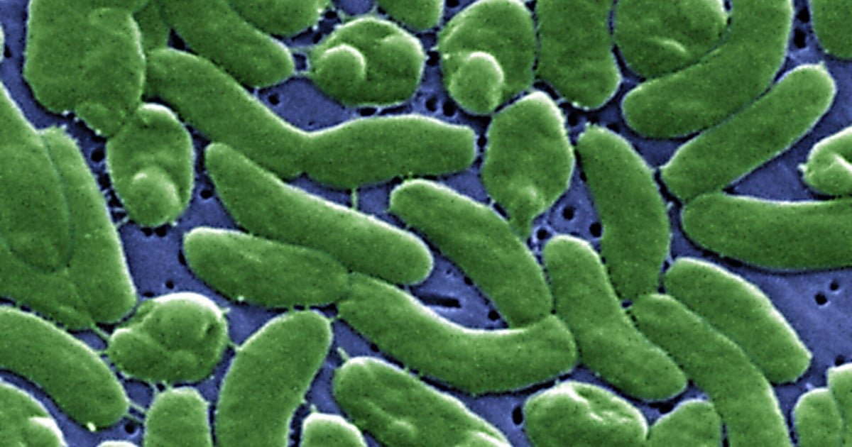 cbsn fusion how to protect yourself from flesh eating bacteria as concern grows for swimmers thumbnail