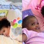cbsn fusion doctors successfully separate twin girls conjoined head thumbnail