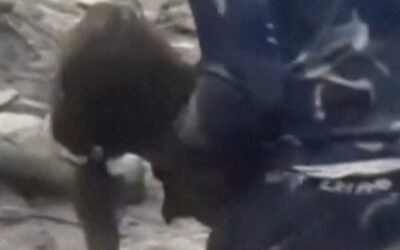 cbsn fusion rare miracle nepal 6 year old pulled jaws death thumbnail