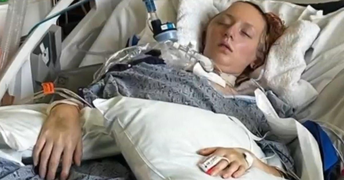 cbsn fusion six flags x2 roller coaster caused over 100 injuries lawsuits say thumbnail